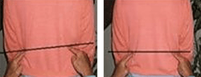 Avant / après soin Quantum Touch - exemple 1